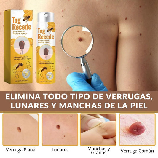 Elimina Verrugas sin Dolor ni Cicatrices